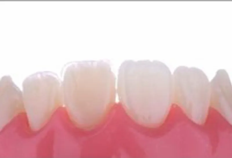 Slide 14