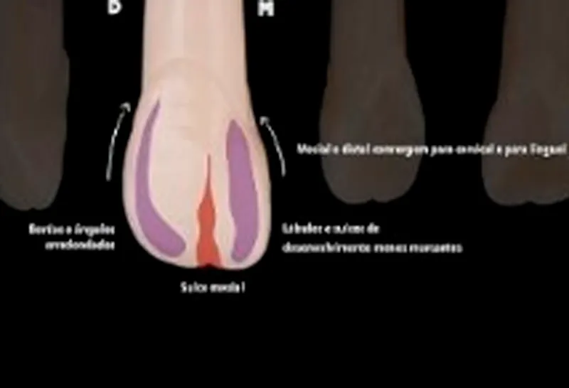 Slide 15