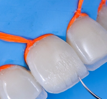 Estética Dental