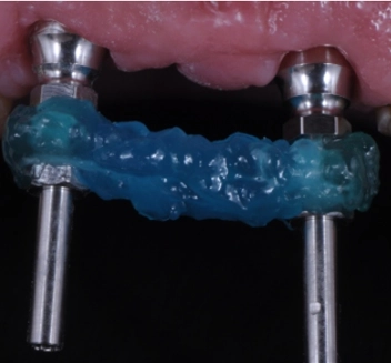 Slide 6